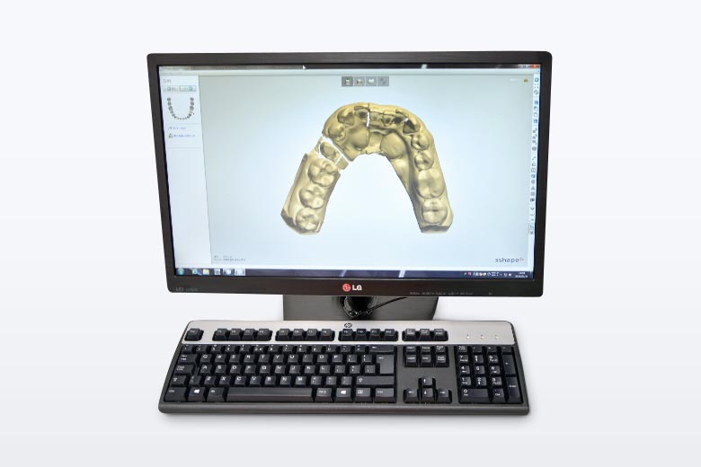 歯科用ＣＡＤ/ＣＡＭ