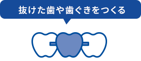 抜けた歯や歯ぐきをつくる